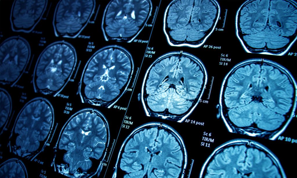 Several MRI brain scans are displayed in a grid.